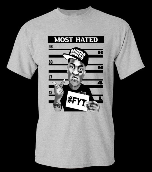 FYT